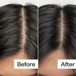 Act+Acre Cold Processed Scalp Renew 2 oz