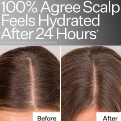 Act+Acre Daily Hydro Scalp Serum 30ml