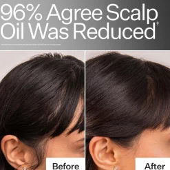 Act+Acre 4% Niacinamide Oily Scalp Serum 65ml