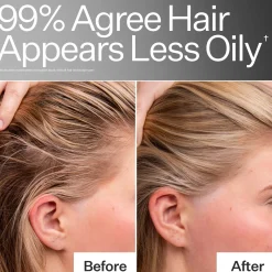 Act+Acre 4% Niacinamide Oily Scalp Serum 65ml
