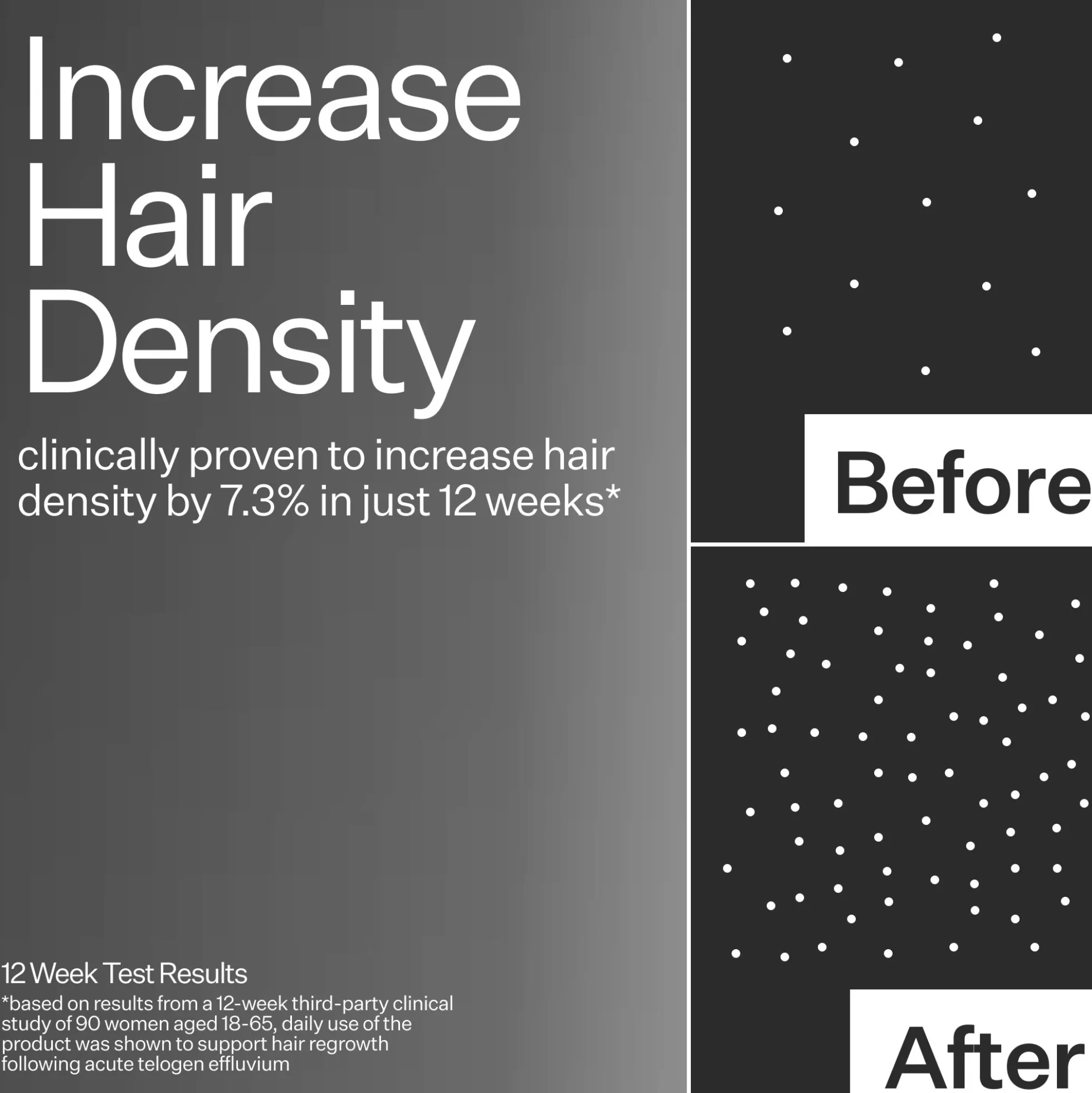 Act+Acre 3% Stem Cell Peptide H3-Grow+ Complex Scalp Treatment For Hair Thinning and Growth 89ml