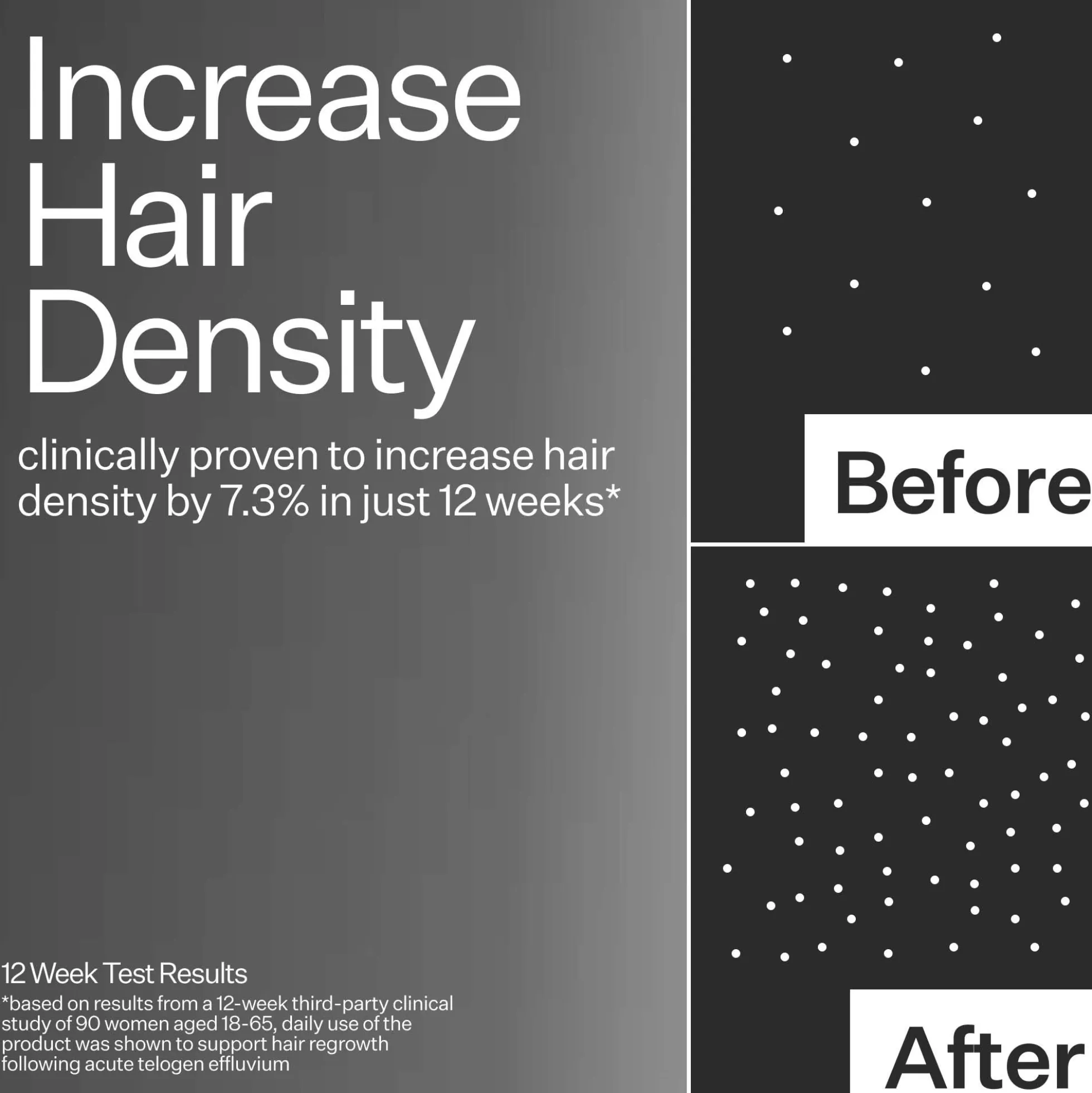 Act+Acre 3% Stem Cell Peptide H3-Grow+ Complex Scalp Treatment For Hair Thinning and Growth 89ml