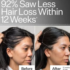 Act+Acre 3% Stem Cell Peptide H3-Grow+ Complex Scalp Treatment For Hair Thinning and Growth 89ml