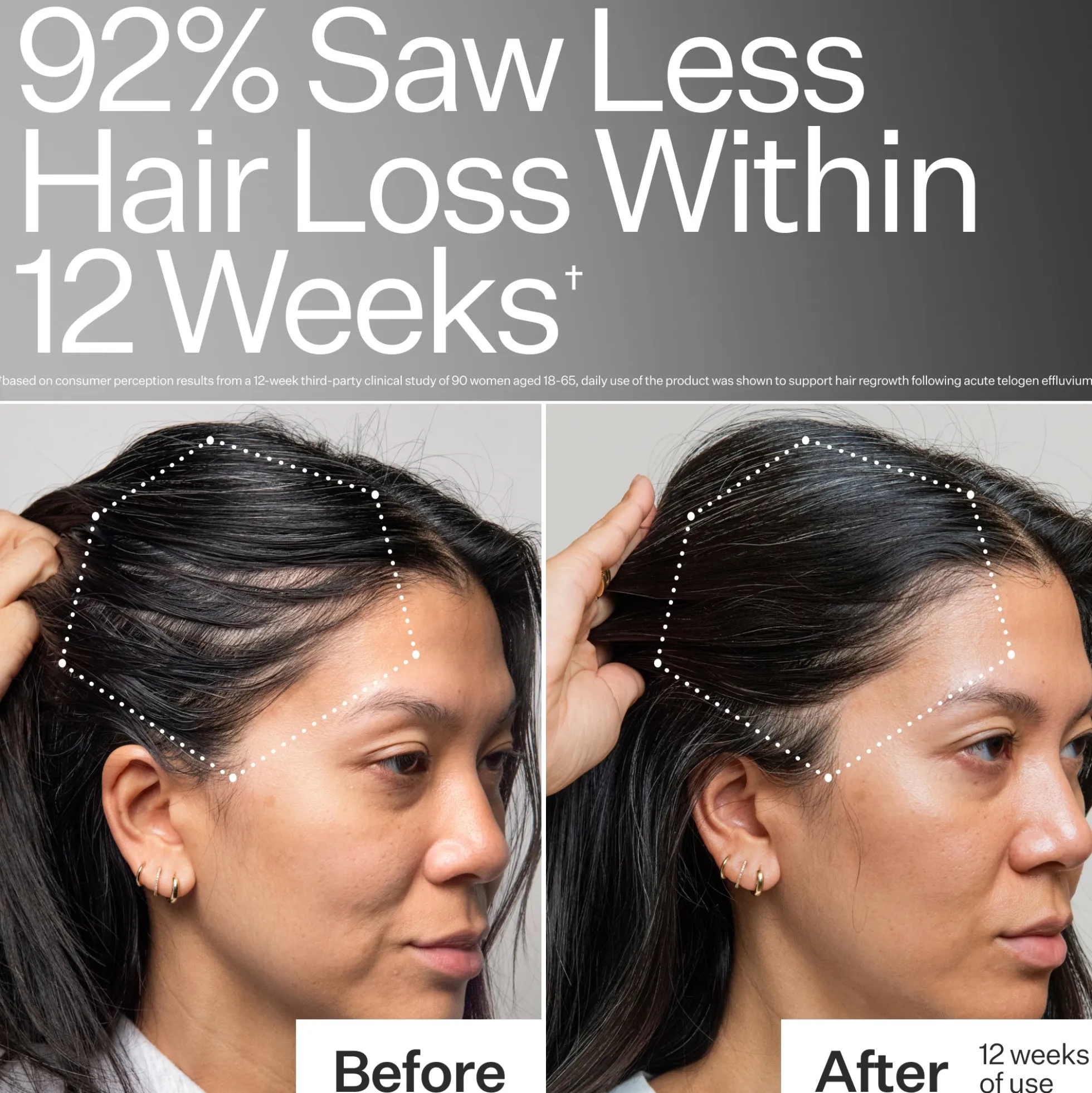 Act+Acre 3% Stem Cell Peptide H3-Grow+ Complex Scalp Treatment For Hair Thinning and Growth 89ml