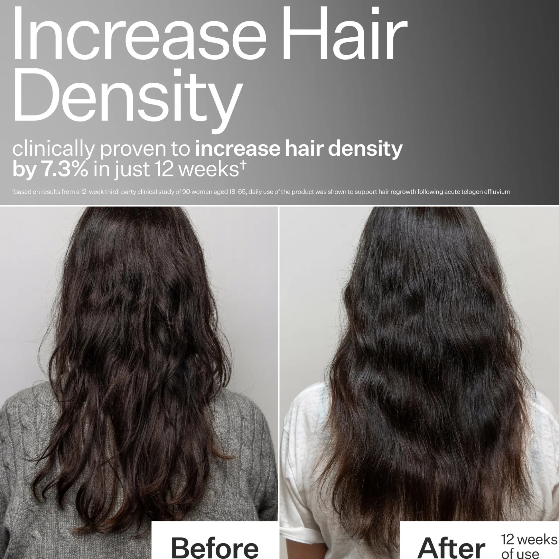 Act+Acre 3% Stem Cell Peptide H3-Grow+ Complex Scalp Treatment For Hair Thinning and Growth 89ml