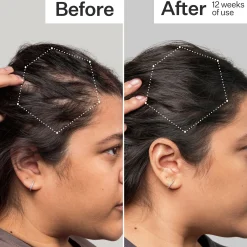 Act+Acre 3% Stem Cell Peptide H3-Grow+ Complex Scalp Treatment For Hair Thinning and Growth 89ml