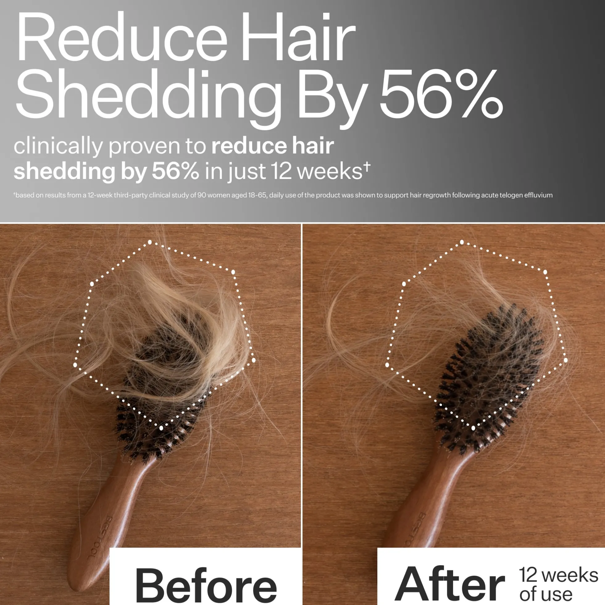 Act+Acre 2% Stem Cell Scalp Serum For Thicker-Looking Hair