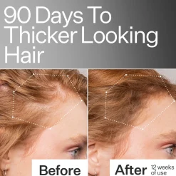 Act+Acre 2% Stem Cell Scalp Serum For Thicker-Looking Hair