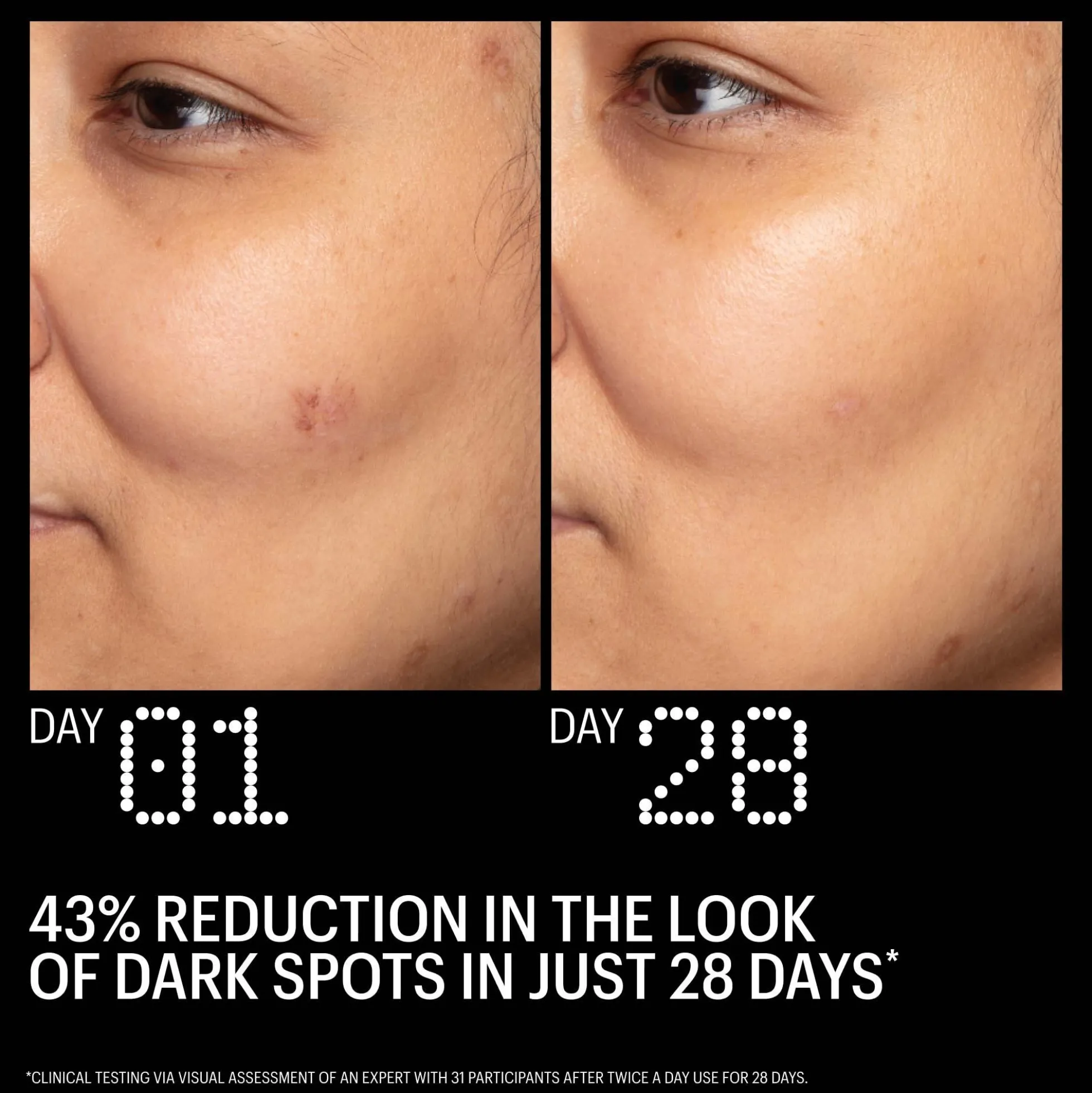 Allies of Skin Azelaic and Kojic Advanced Clarifying Serum 30ml