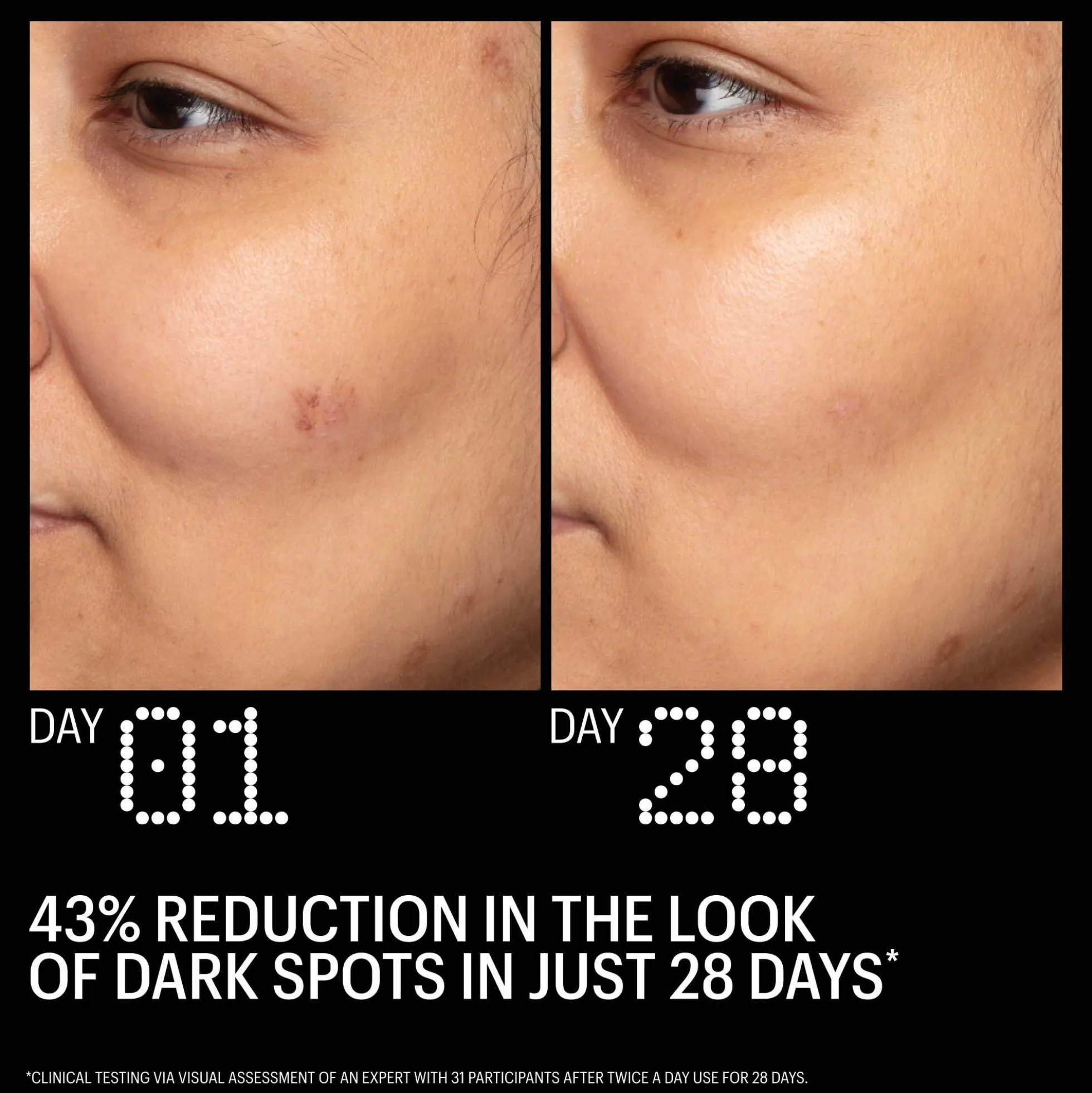 Allies of Skin Azelaic & Kojic Advanced Clarifying Serum 50ml