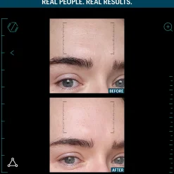 Allies of Skin Multi Peptides & Growth Factors Advanced Lifting Serum 7ml