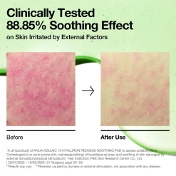 Anua Azelaic 10 Hyaluron Redness Soothing Pad 230ml