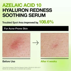 Anua K-Pop Demon Hunters Calming Skin Discovery Set (Worth £27.00)