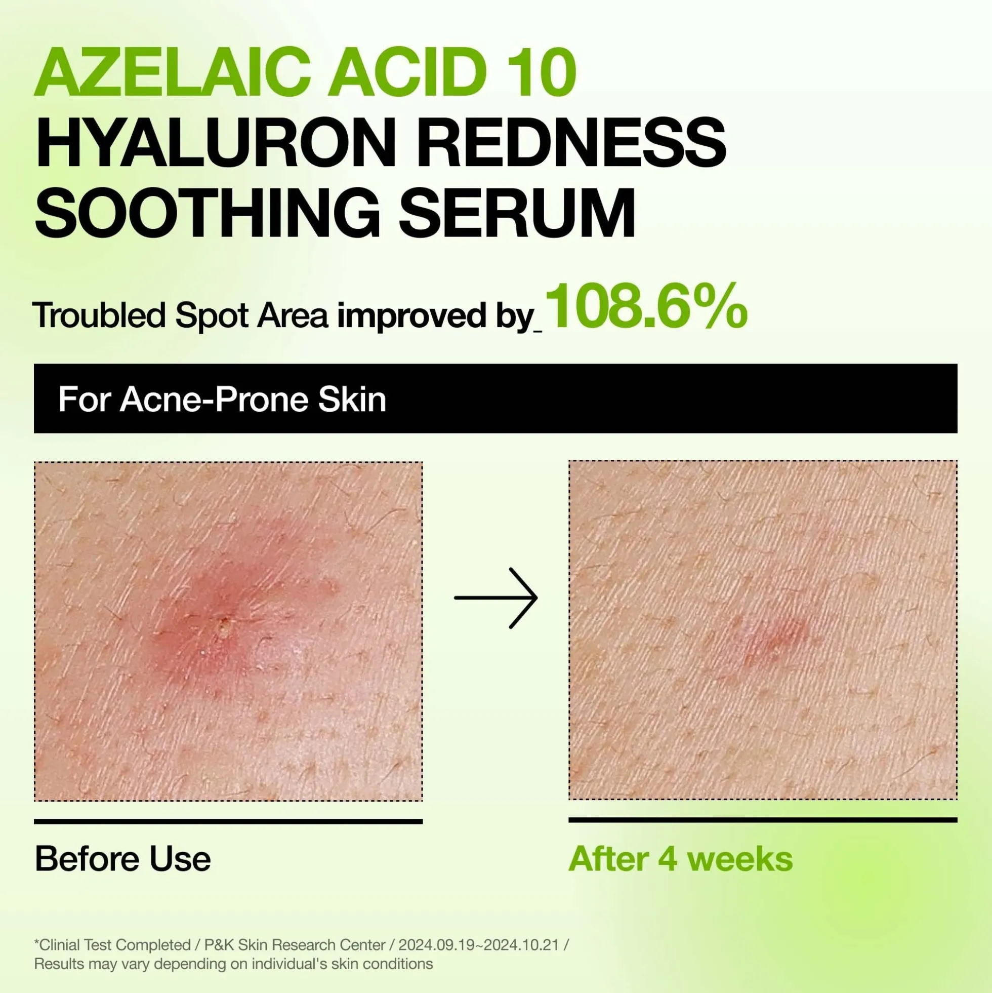 Anua K-Pop Demon Hunters Calming Skin Discovery Set (Worth £27.00)
