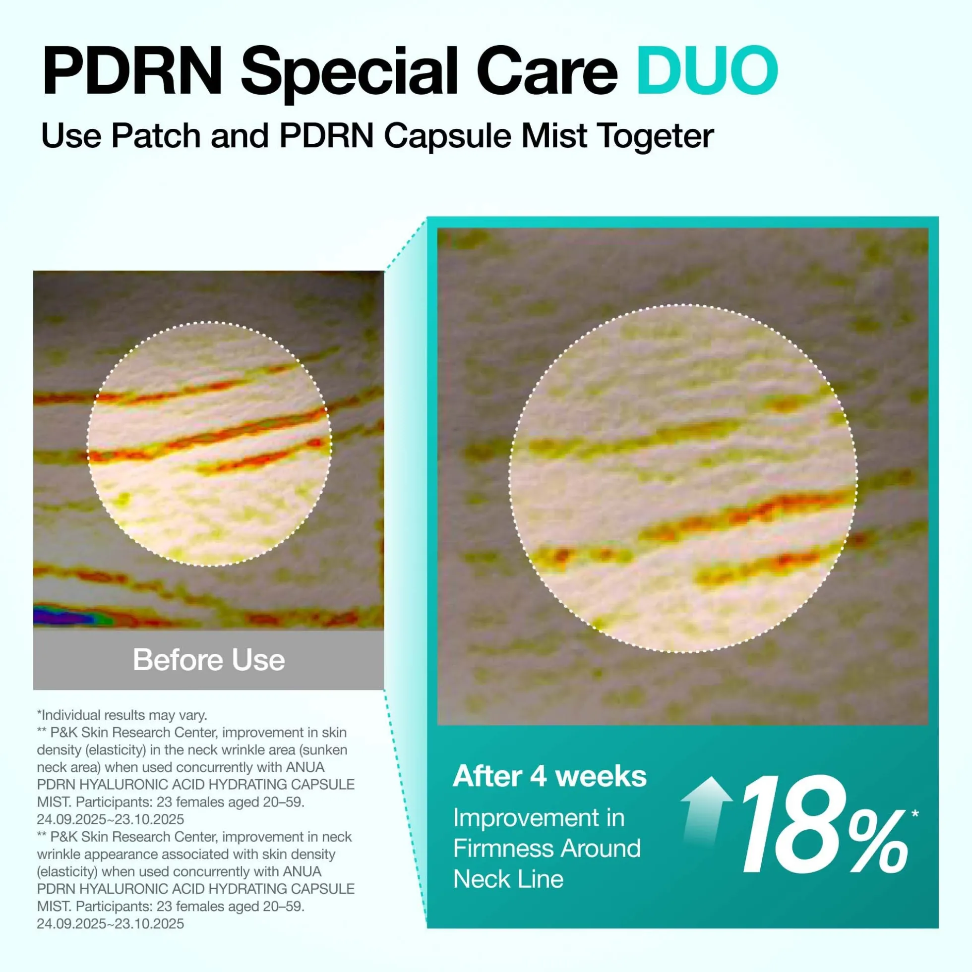 Anua PDRN Collagen Melting Patch For Neck (4 Pack)