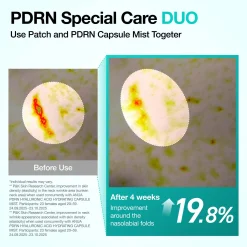 Anua PDRN Collagen Melting Patch For Glass Skin (4 Pack)