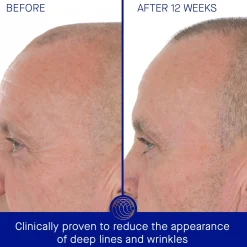 Augustinus Bader The Retinol Serum 30ml