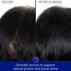 Augustinus Bader The Scalp Treatment 30ml