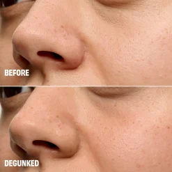 Benefit The Porefessional Degunker Blackhead And Pore Cleansing System For Clogged Pores