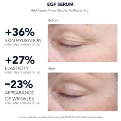 BIOEFFECT EGF Serum 15ml