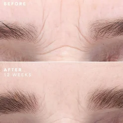 BIOEFFECT EGF Serum 15ml
