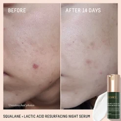 Biossance Squalane and Lactic Acid Resurfacing Serum 30ml