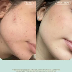 Biossance Squalane + Probiotic Gel Moisturiser 50ml