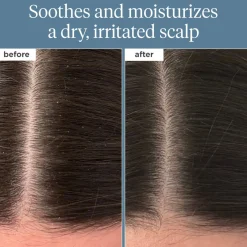 Briogeo Scalp Revival Rosemary Pre-Wash Oil for Hair and Scalp 100ml