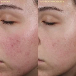 BYOMA Blemish Control Moisturiser 50ml