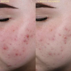 BYOMA Blemish Redness Relief Soothing Toner 100ml
