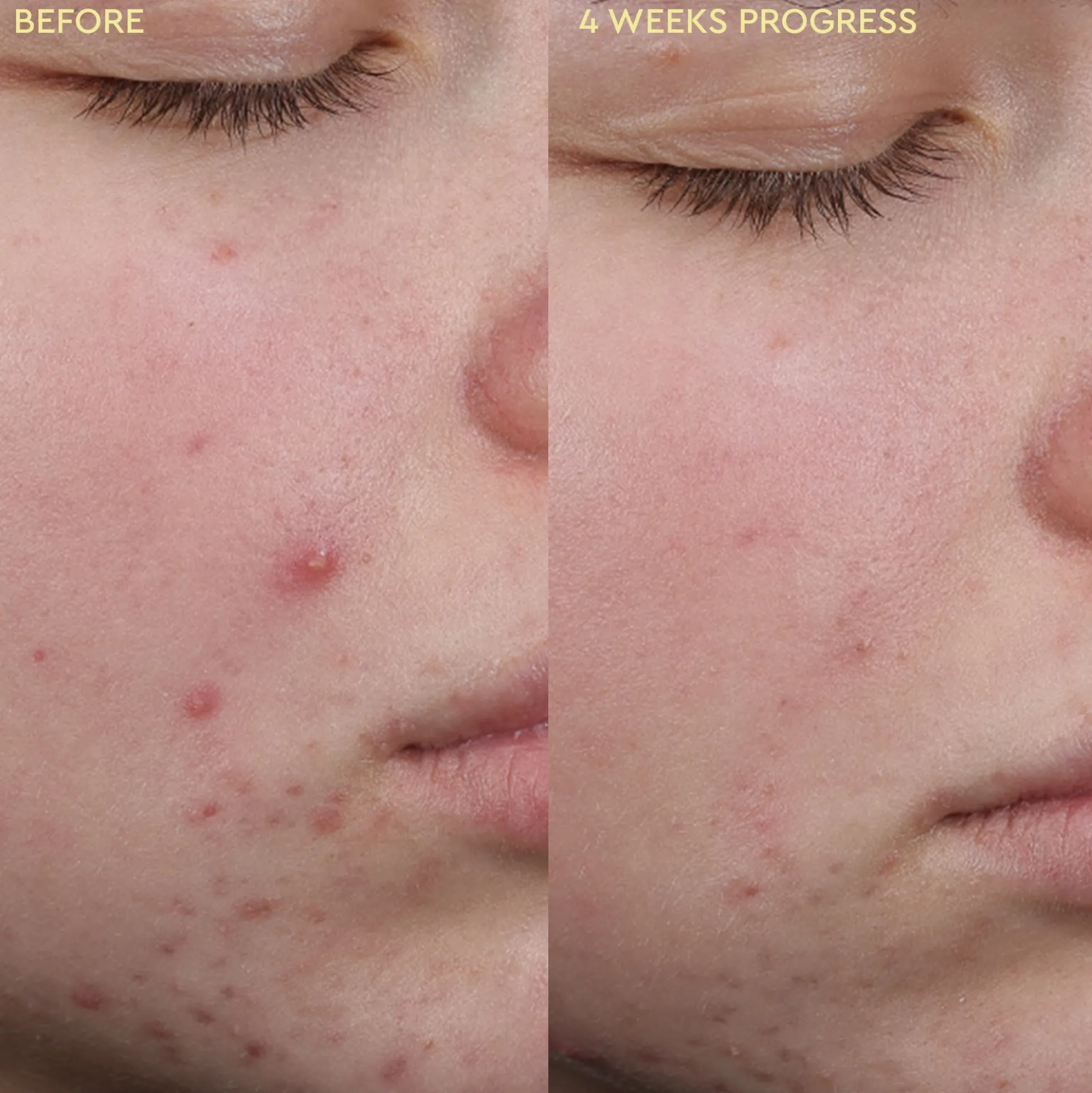 BYOMA Blemish System