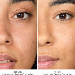 By Terry Hyaluronic Serum Concealer (Various Shades)