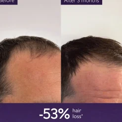 Caudalie Anti-Hair Loss Serum 50ml