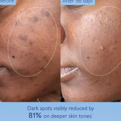 Caudalie Vinoperfect Brightening Dark Spot Serum for Hyperpigmentation Vitamin C Alternative​ 30ml