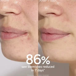 Caudalie Vinopure Blemish Control Salicylic Serum 30ml