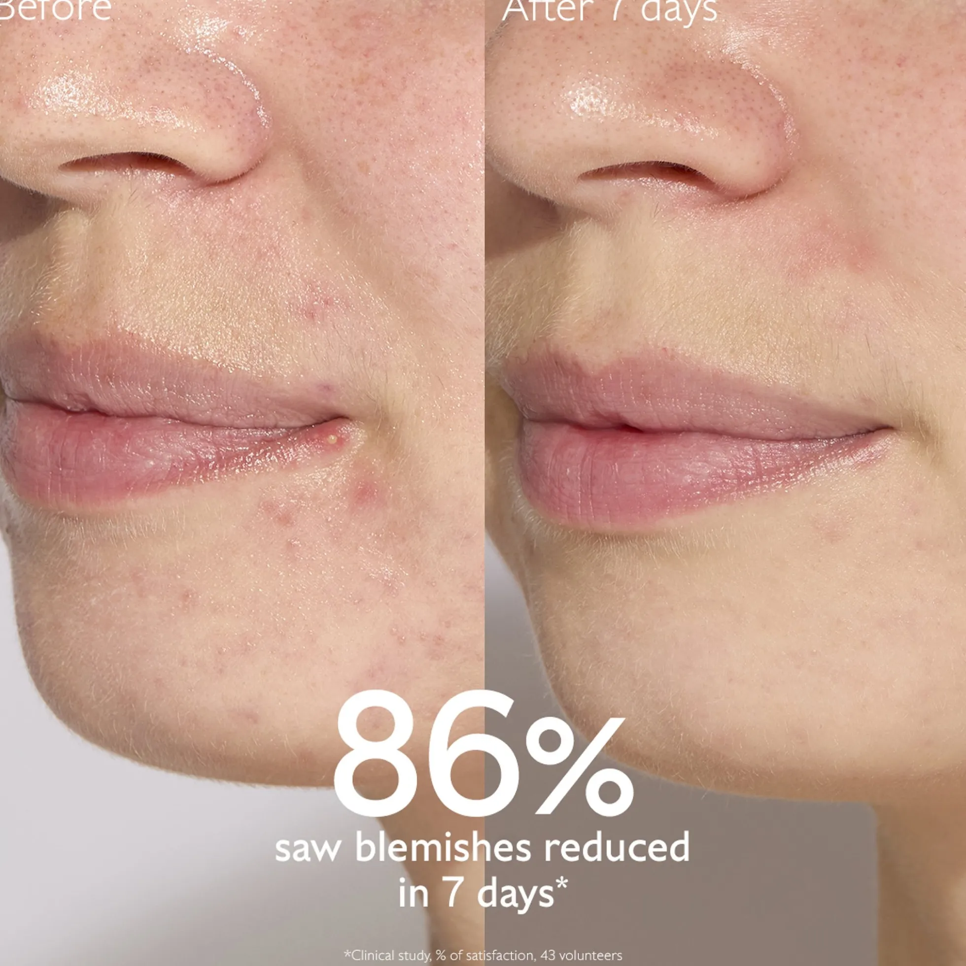 Caudalie Vinopure Blemish Control Salicylic Serum 30ml