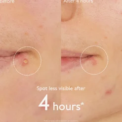 Caudalie Vinopure Salicylic Spot Solution 15ml