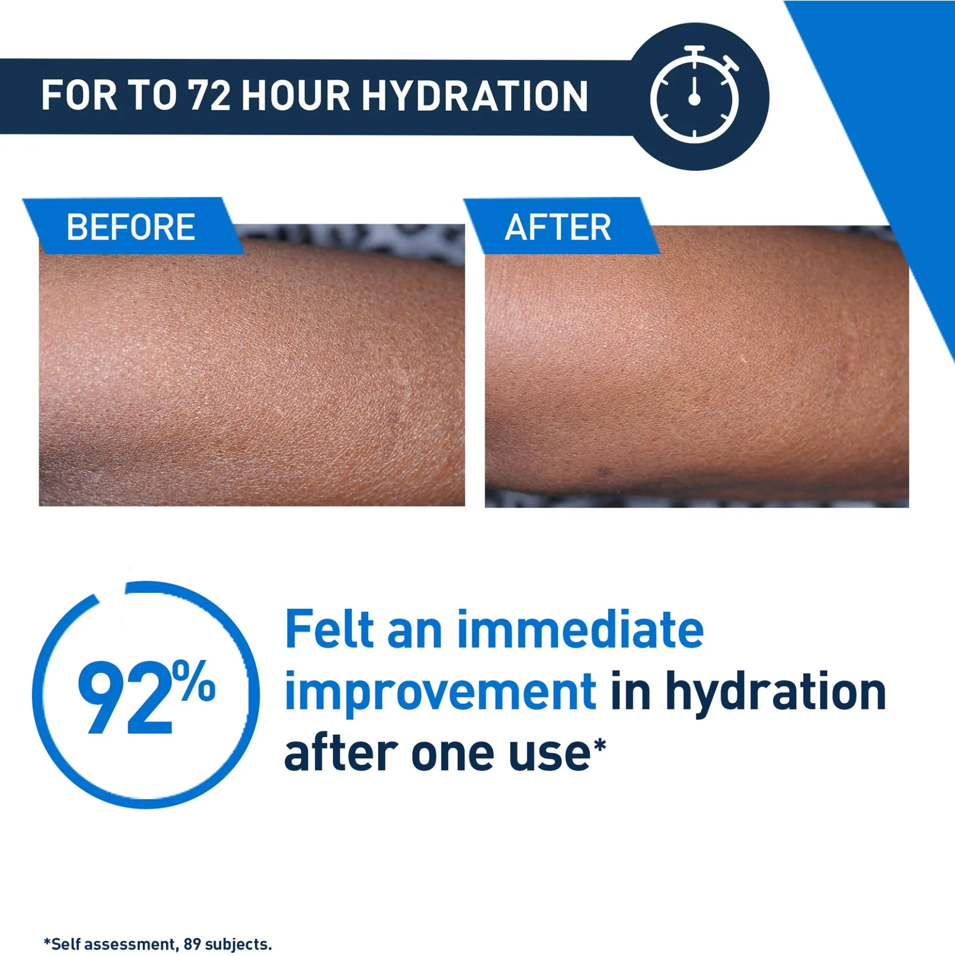 CeraVe Intensive Moisturising Lotion for Very Dry Skin 473ml
