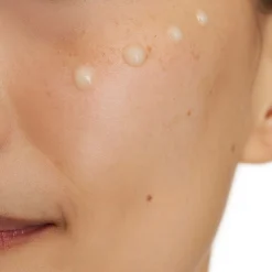 CeraVe Skin Renewing 10% Pure Vitamin C Serum with Ceramides for Brighter & Smoother Skin 30ml
