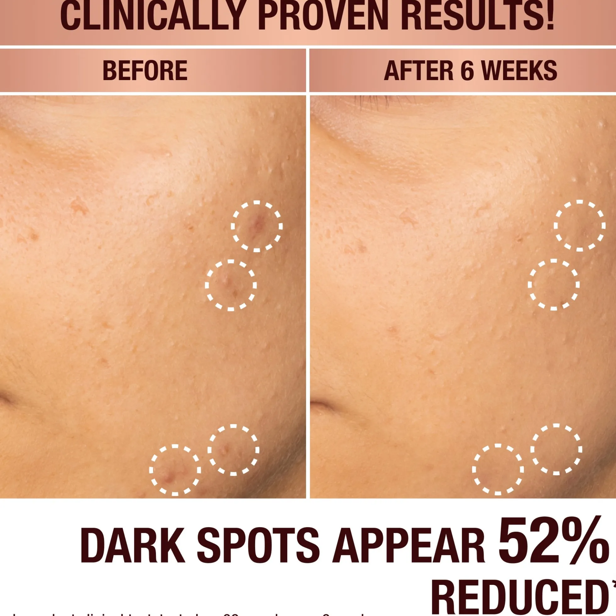 Charlotte Tilbury Dark Spots Correcting Radiance Recovery Serum - 10ml