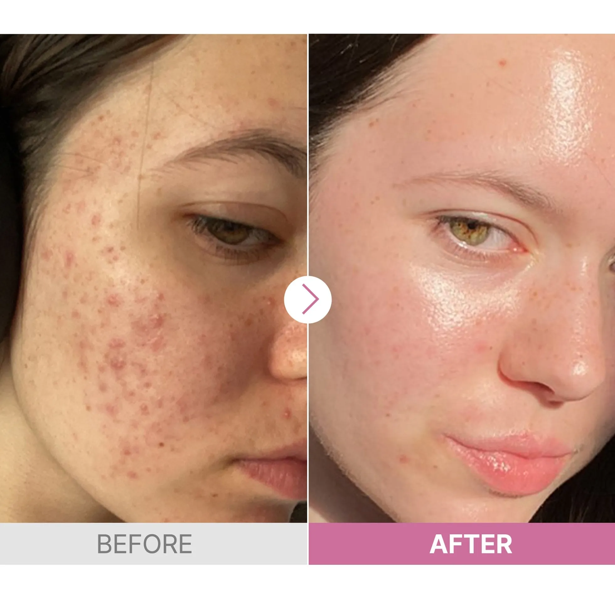 COSRX The Niacinamide 15 Serum 20ml