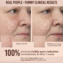 Danessa Myricks Beauty Yummy Skin 10/10 BARRIER BOOST HA + Ectoin Plumping Serum