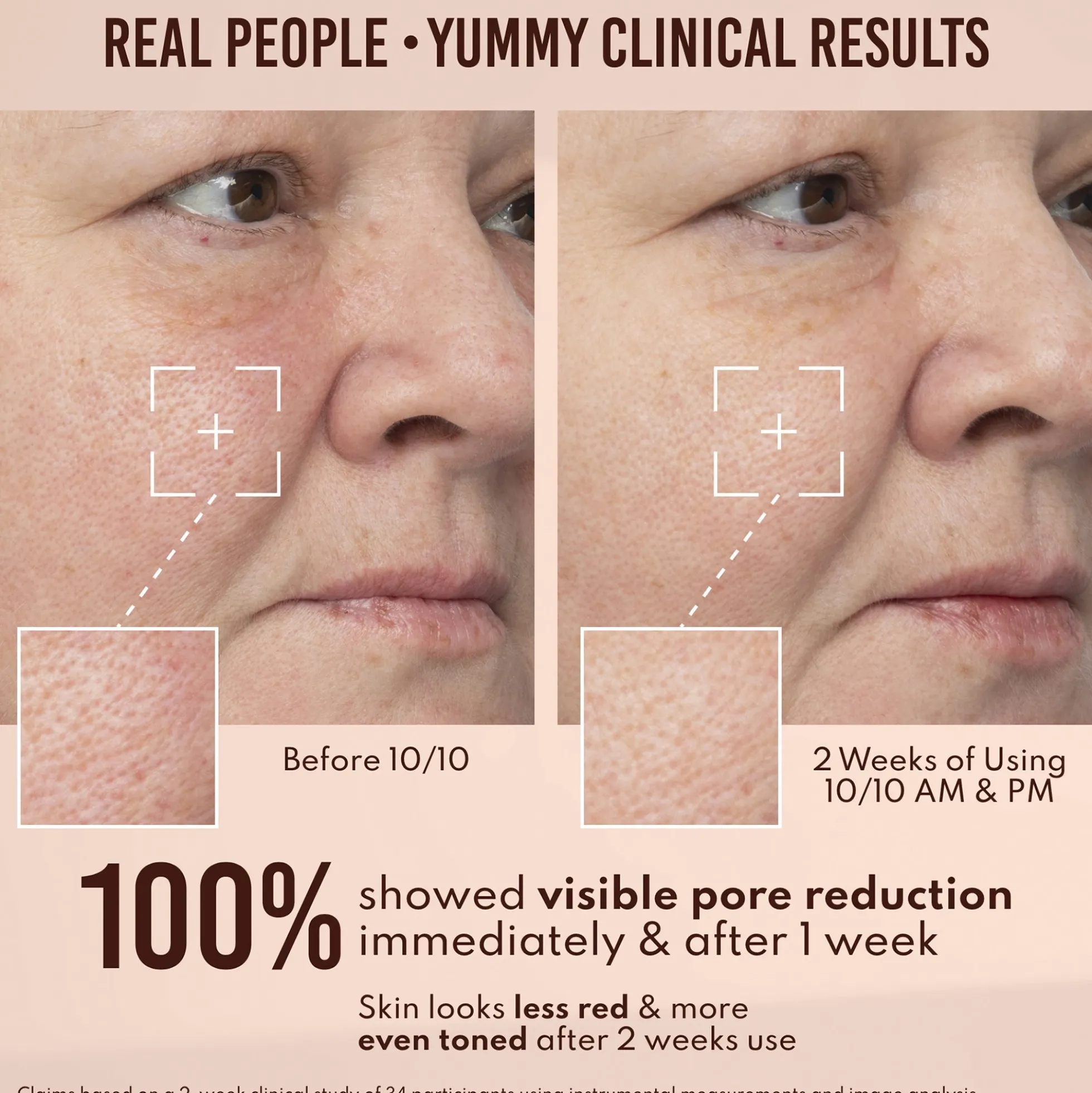 Danessa Myricks Beauty Yummy Skin 10/10 BARRIER BOOST HA + Ectoin Plumping Serum