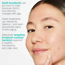 Dermalogica Acne Biotic Moisturiser 50ml