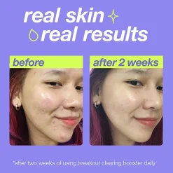 Dermalogica Breakout Clearing Booster