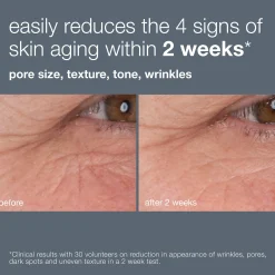 Dermalogica Dynamic Skin Retinol Serum 30ml
