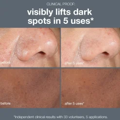 Dermalogica PowerBright Dark Spot Peel 90g
