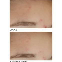 Dr Dennis Gross Alpha Beta On The Spot Gel 30ml