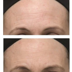 Dr Dennis Gross Alpha Beta Ultra Gentle Peel (30 Pack)