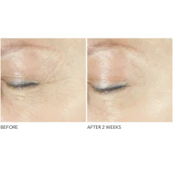Dr. Dennis Gross Skincare Advanced Retinol + Ferulic Triple Correction Eye Serum